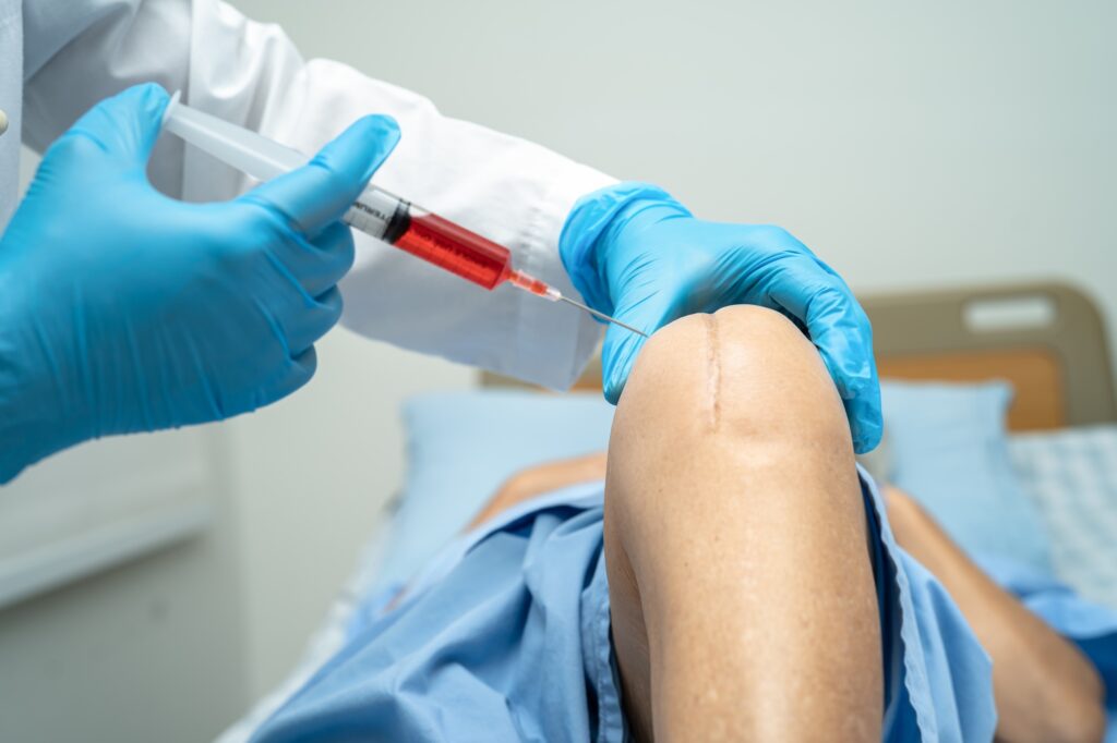Asian doctor inject Hyaluronic acid platelet rich plasma into the knee of senior woman to walk